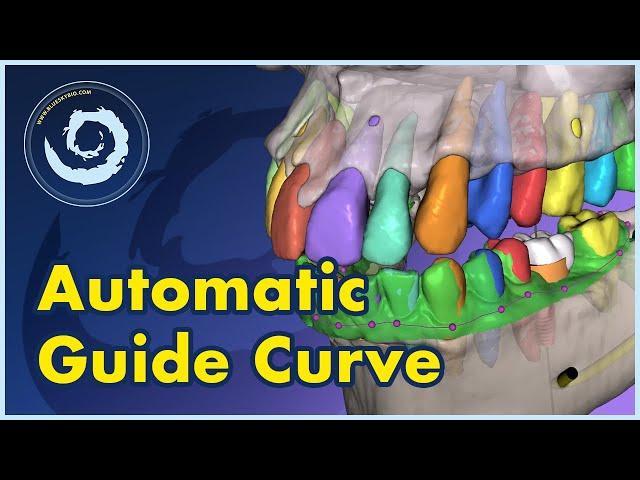 BSP V4.13: Automatic Surgical Guide Curve: The Future of Surgical Guides is Here!