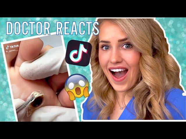 Doctor reacts to WILD foot callus TikToks