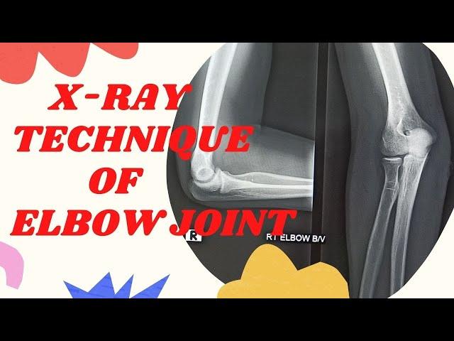 Technique of Elbow joint (Ep-58) | x-ray elbow joint ap & lateral view |