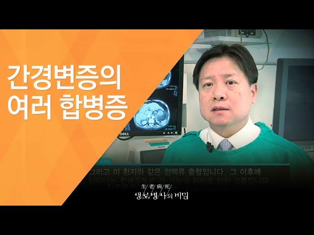 간경변증의 여러 합병증 - (2011.2.12_361회 방송)_당신의 간이 굳어간다 침묵의 질환, 간경화!