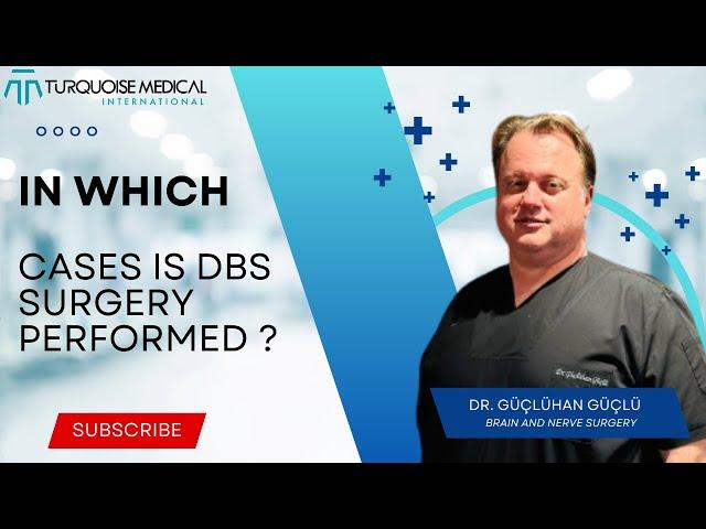 In which cases is DBS surgery performed ? - Brain And Nerve Surgery