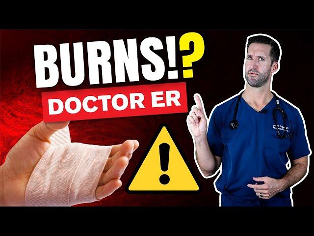 HOW TO TREAT A BURN — ER Doctor Explains Treating Burns, Blisters, Classifications, & Degrees