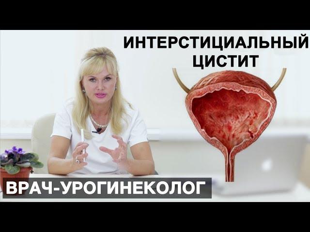 Интерстициальный цистит - что это такое