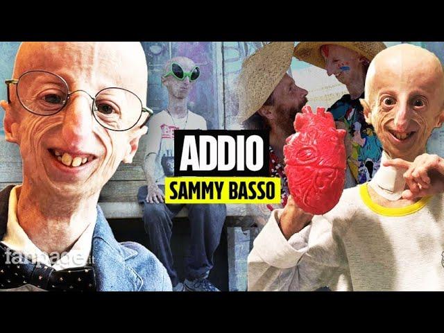 Morto Sammy Basso, si è sentito male al ristorante. L’Associazione Progeria: “Spenta la nostra luce”