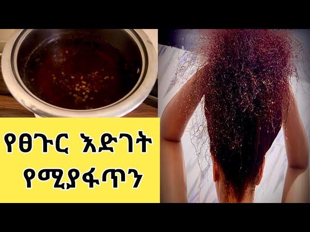 ፀጉር የሚያሳድግ ፎረፎርና የሚያሳክክ የሚያጠፋ /Hair grower /ASTU TUBE/ Ethiopia
