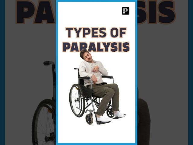 5 Types of Paralysis