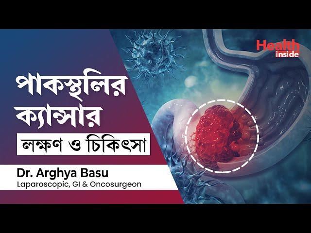 পাকস্থলীর ক্যান্সারের লক্ষণ, কারণ ও চিকিৎসা | Stomach Cancer Symptoms, Causes & treatment in Bengali