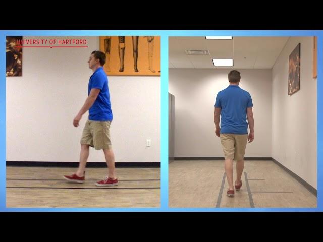 Dynamic Gait Index (DGI)