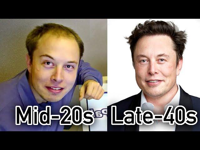 Elon Musk Hair Transplant EXPOSED