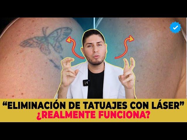 Tecnicas de eliminación de tatuaje ¿El láser es mejor? | DOCTOR LEMUS