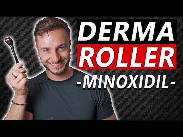 How To Use Derma Roller and Minoxidil to Regrow Hair!