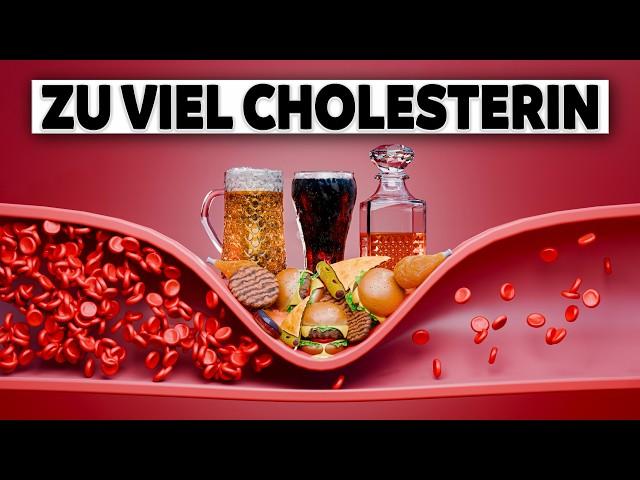 Cholesterin senken: Top 5 Lebensmittel (Wenig bekannt)