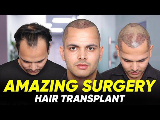 Hair Transplant in Ahmedabad | Best Results & Cost of Hair Transplant in Ahmedabad