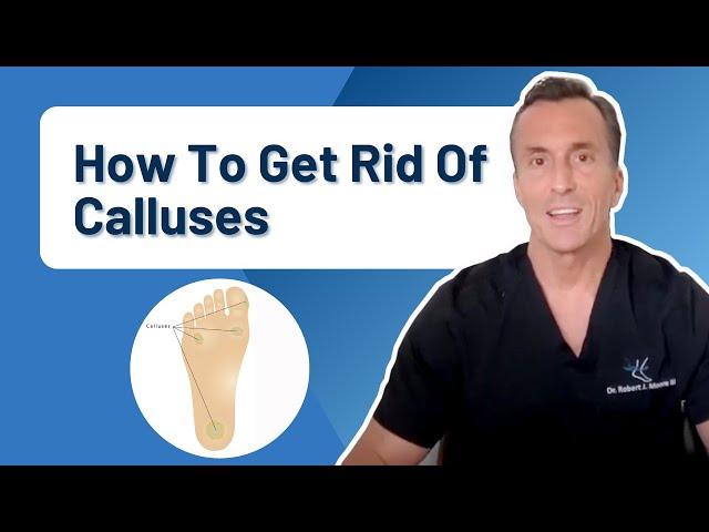 How Do You Get Rid Of Calluses Permanently?