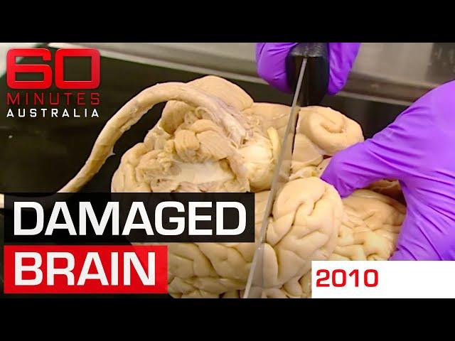 Dissecting an athlete's brain to determine the real impact of contact sports | 60 Minutes Australia