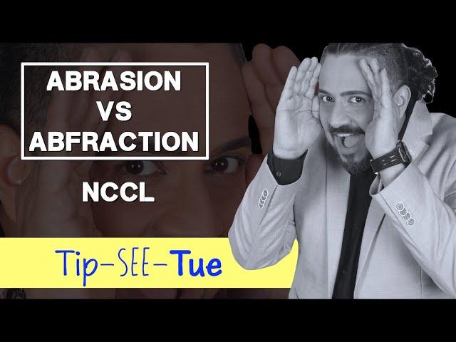 Abrasion vs Abfraction: Tip-See-Tue #learningwithmik