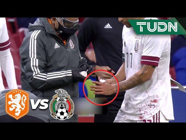 ¿Qué le pasó? ¡APARATOSA lesión de Govea! | Holanda 0-1 México | Amistoso 2020 | TUDN