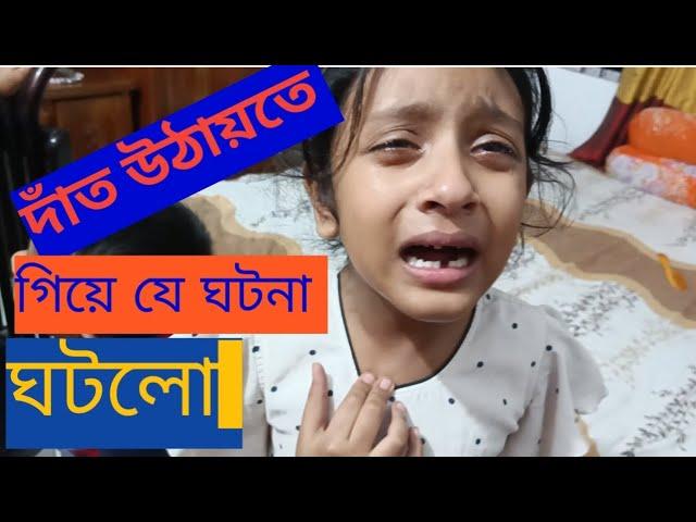 দাঁত উঠায়তে গিয়ে যে ঘটনা ঘটলো।The incident that happened while removing the tooth.