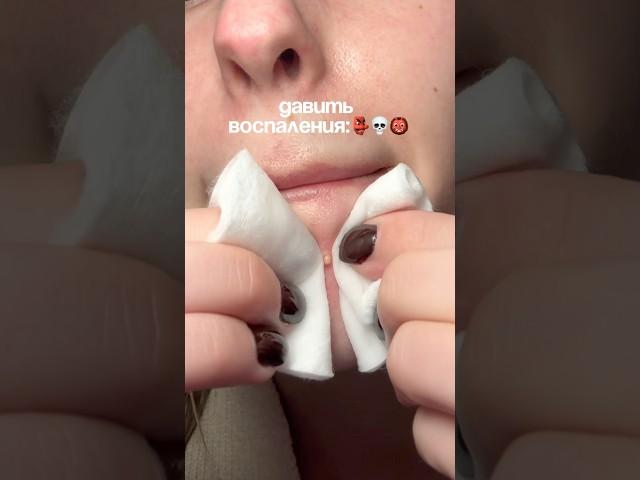 ДАВИТЬ ИЛИ НЕТ? сыворотка: 142054898 #воспаления #гигиена #кожа #уход РП