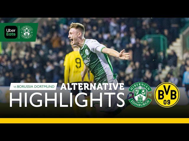 Hibernian 1 Borussia Dortmund 2 | Alternative Angle Highlights | UEFA Youth League