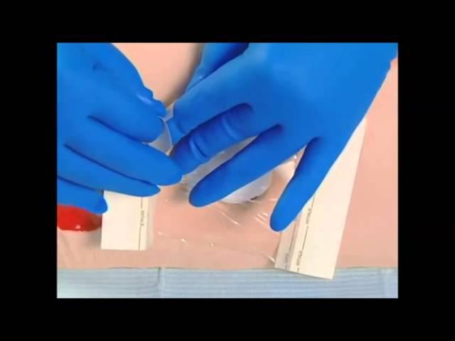 Transparent Film Wound Dressings | Autolytic Debridement Options | WoundEducators.com