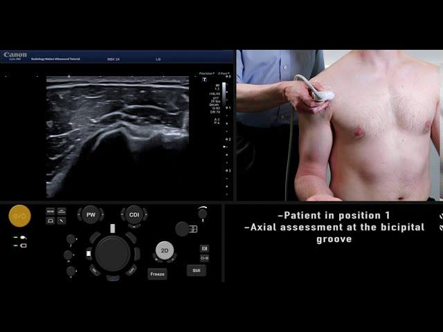 Ultrasound Tutorial: MSK Series: Shoulder / Rotator Cuff | Radiology Nation