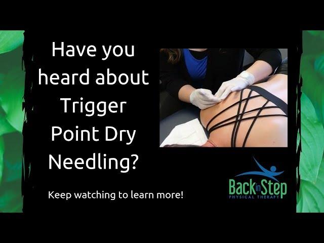 Trigger Point Dry Needling