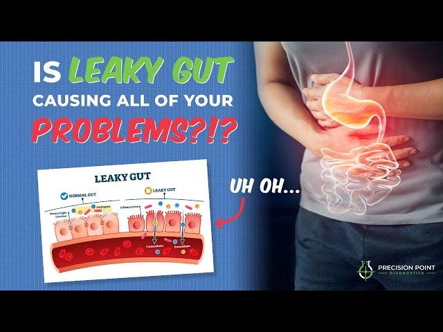 Is Leaky Gut Causing All Of Your Problems?!? (The Advanced Intestinal Barrier Assessment)