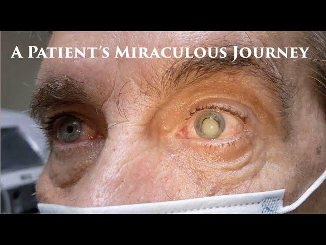 A Patient's Miraculous Journey - Baseball Injury - Cataract Surgery - Ode to Ophthalmology -Dr. Krad