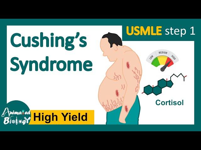 Cushing's syndrome | How is Cushing syndrome diagnosed? | Treatment of Cushing's syndrome | USMLE