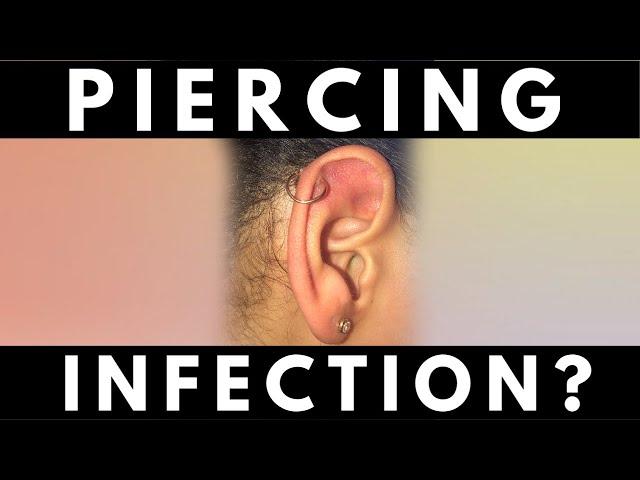 PIERCING INFECTIONS OR IRRITATION? | How Do I Know I Have One?