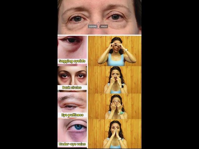 Eye Yoga for Bright & Healthy Eyes | Siddhi Yoga
