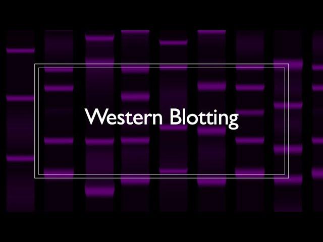 Western Blot Protocol Overview