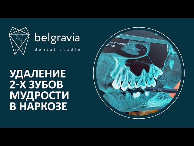 Удаление 2-х зубов мудрости в наркозе. Клинический случай