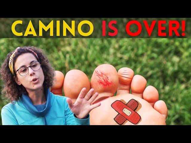 85% of blisters can be prevented before the Camino, five expert hacks!