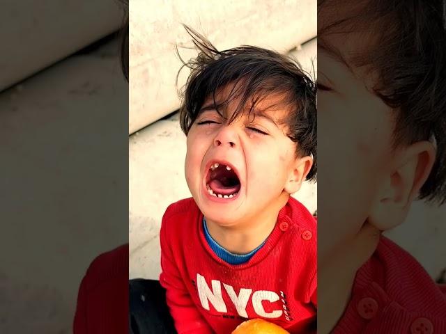 A child dies and her brother cries by burning him 