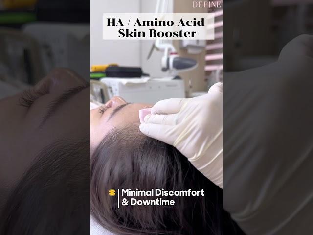 HA Skin Booster 水光针 | Define Aesthetic Medical Clinic