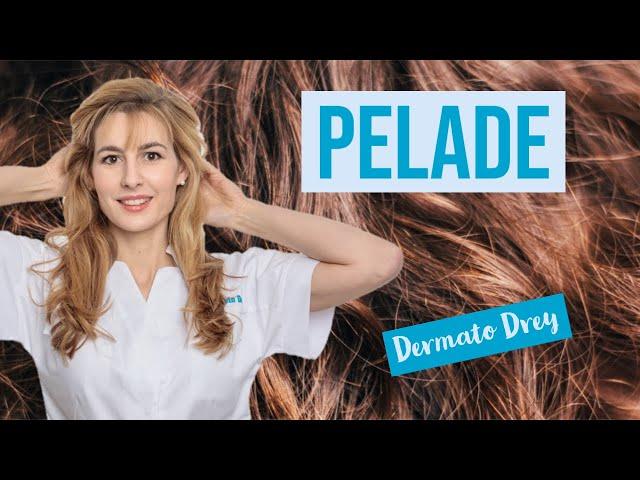 La pelade ! Perdre ses cheveux, et les retrouver ! Alopécie areata #DermatoDrey