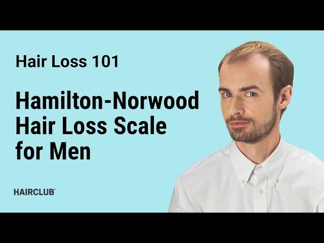 Hamilton-Norwood Hair Loss Scale for Men - Male Pattern Baldness