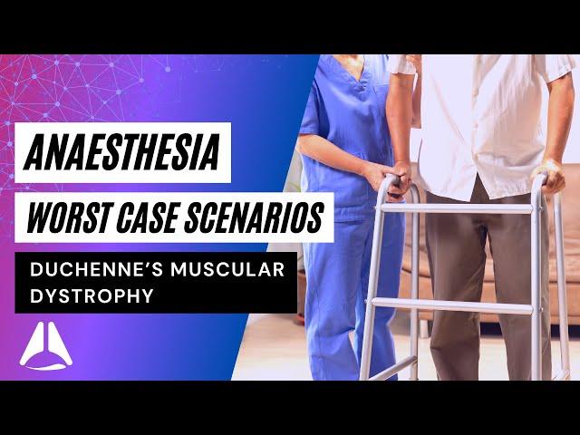 Duchenne's Muscular Dystrophy Anaesthesia Final Exam Case | #anesthesia #duchennemusculardystrophy