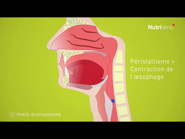 Dysphagie (troubles de la déglutition) et Fausse route, qu'est-ce que c'est ?