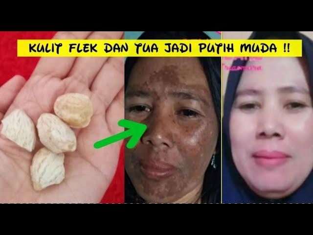 RESEP HILANGKAN FLEK DAN KERIPUT  DALAM 1 MENIT DENGAN KEMIRI/BUAH KERAS