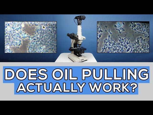 Oil Pulling for 35 Days: Did It Cure Gum Disease? Microscope Analysis