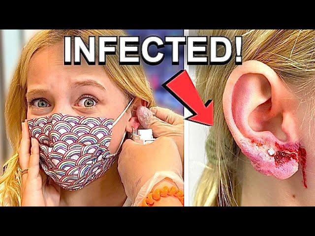 INFECTION DISASTER! I got a NEW Ear Piercing and THIS HAPPENED! *GROSS WARNING*