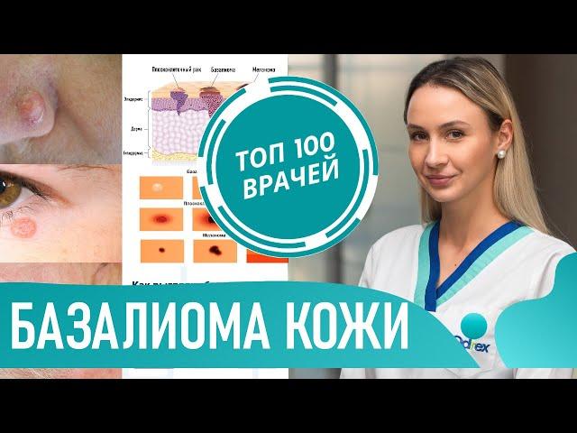 Как выглядит базалиома (фото 1-7). Базальноклеточный рак кожи. Базальноклеточная карцинома