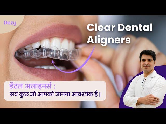 Clear Aligners 101: Invisible Braces, Cost & Straight Smile Treatment Explained in Hindi