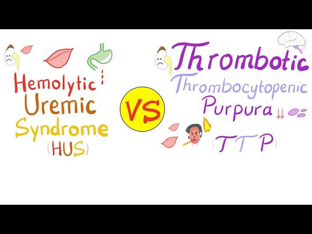 Hemolytic Uremic Syndrome (HUS) vs. Thrombotic Thrombocytopenic purpura (TTP)