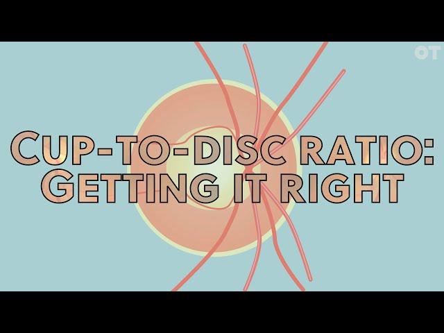 Cup-to-disc ratio: getting it right | OT Skills Guide