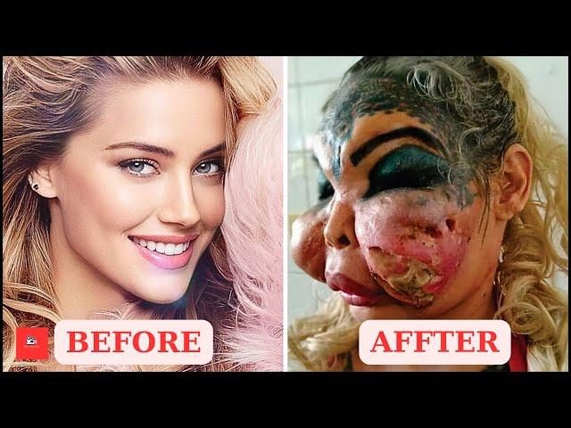 Famous Celebrities Unrecognizable After Plastic Surgery Gone Wrong | Then and Now 2024