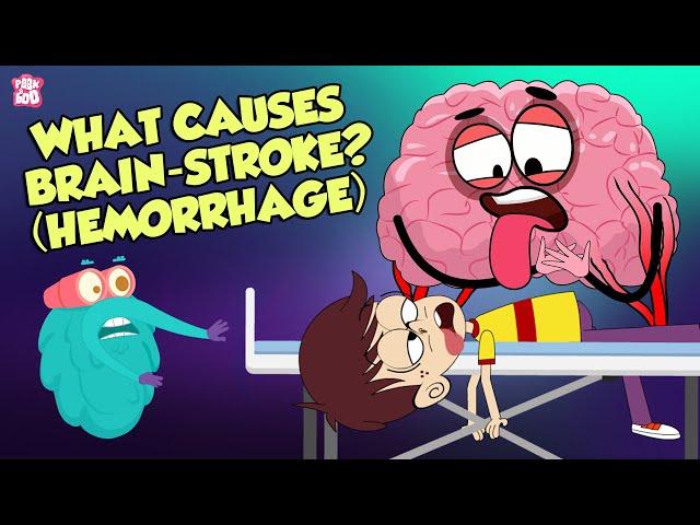 What Causes A Brain Stroke? | Brain Attack | The Dr Binocs Show | Peekaboo Kidz